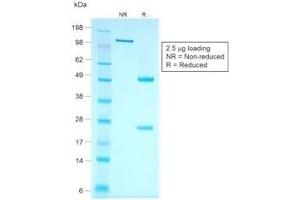 SDS-PAGE (SDS) image for anti-Keratin 7 (KRT7) antibody (ABIN6939869)