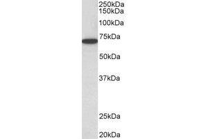 Western Blotting (WB) image for anti-Histone Deacetylase 1 (HDAC1) (C-Term) antibody (ABIN2465043) (HDAC1 antibody  (C-Term))