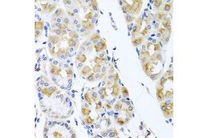 Immunohistochemistry of paraffin-embedded human stomach using TMEM43 antibody. (TMEM43 antibody)