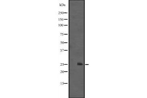 Western blot analysis of IL1F6 expression in HEK293 cells ,The lane on the left is treated with the antigen-specific peptide. (IL36A/IL1F6 antibody  (Internal Region))