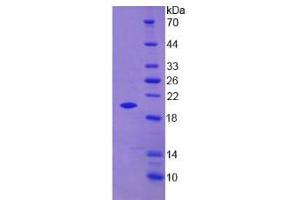 SDS-PAGE analysis of Mouse PGLYRP1 Protein. (PGLYRP1 Protein)