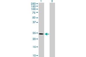 Western Blot analysis of SOHLH2 expression in transfected 293T cell line by SOHLH2 MaxPab polyclonal antibody. (SOHLH2 antibody  (AA 1-225))