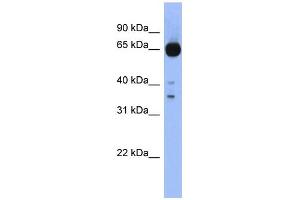 WB Suggested Anti-ZIC4 Antibody Titration:  0. (ZIC4 antibody  (Middle Region))