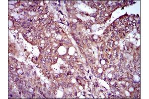 Immunohistochemistry (IHC) image for anti-Zinc Finger Protein 42 (ZFP42) (AA 249-310) antibody (ABIN1724849)