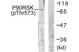 Western blot analysis of extracts from 293 cells treated with UV using p90 RSK (Phospho-Thr573) Antibody. (RPS6KA1 antibody  (pThr573))