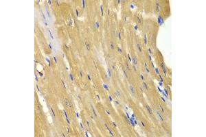 Immunohistochemistry of paraffin-embedded mouse heart using AK1 antibody (ABIN5970560) at dilution of 1/100 (40x lens). (Adenylate Kinase 1 antibody)