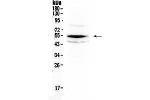 Western blot analysis of Chk1 using anti- Chk1 antibody . (CHEK1 antibody  (AA 1-210))
