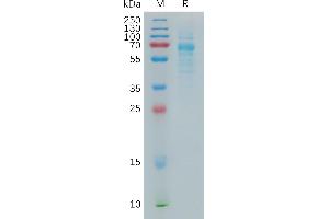 Human CO Protein, hFc Tag on SDS-PAGE under reducing condition. (COLEC10 Protein (AA 28-277) (Fc Tag))