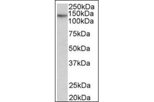 Staining of Skeletal Muscle lysate (35µg protein in RIPA buffer) using TERT antibody at 0. (TERT antibody  (Internal Region))