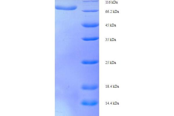 D2HGDH Protein (AA 14-521) (His-SUMO Tag)