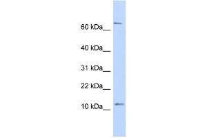 Western Blotting (WB) image for anti-Nuclear Receptor 2C2-Associated Protein (NR2C2AP) antibody (ABIN2459661) (NR2C2AP antibody)