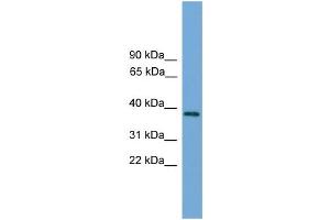 WB Suggested Anti-C22orf36 Antibody Titration: 0. (LRRC75B/FAM211B antibody  (Middle Region))