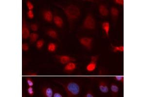 Immunofluorescence analysis of U2OS cells using ATP7B Polyclonal Antibody (ATP7B antibody)