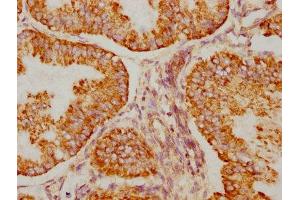 Immunohistochemistry (IHC) image for anti-BCL2-Antagonist/killer 1 (BAK1) antibody (ABIN7127362)