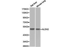 Western Blotting (WB) image for anti-Aldehyde Dehydrogenase 2 Family (Mitochondrial) (ALDH2) antibody (ABIN1870925) (ALDH2 antibody)