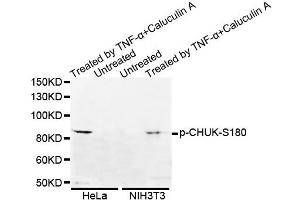 Western blot analysis of extracts of various cell lines, using Phospho-CHUK-S180 antibody. (IKK alpha antibody  (pSer180))