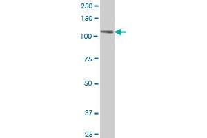 PTK7 monoclonal antibody (M02), clone 4C6 Western Blot analysis of PTK7 expression in A-431 . (PTK7 antibody  (AA 36-145))