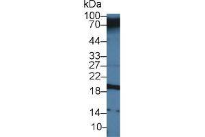 Western Blot; Sample: Human Serum; Primary Ab: 3µg/ml Rabbit Anti-Human CEACAM7 Antibody Second Ab: 0. (CEACAM7 antibody  (AA 147-231))