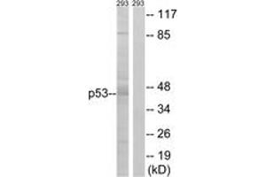 Western blot analysis of extracts from 293 cells, using p53 (Ab-46) Antibody. (p53 antibody  (AA 26-75))