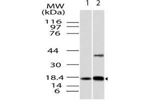 Image no. 1 for anti-Acid Phosphatase 1, Soluble (ACP1) antibody (ABIN5027691) (ACP1 antibody)