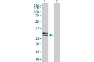 Western Blotting (WB) image for HLA-DPA1 293T Cell Transient Overexpression Lysate(Denatured) (ABIN1332133)