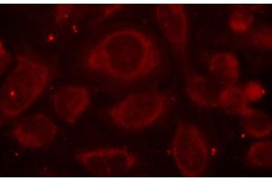 Immunofluorescence (IF) image for anti-Nuclear Factor-kB p65 (NFkBP65) (pSer468) antibody (ABIN1870585) (NF-kB p65 antibody  (pSer468))