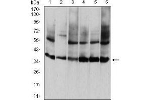 Western blot analysis using ANXA5 mouse mAb against HepG2 (1), PNAC-1 (2), NIH/3T3 (3), Hela (4), MCF-7 (5), and A431 (6) cell lysate. (Annexin V antibody  (AA 160-320))