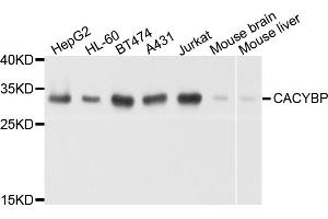 Western blot analysis of extracts of various cell lines, using CACYBP antibody. (CACYBP antibody)
