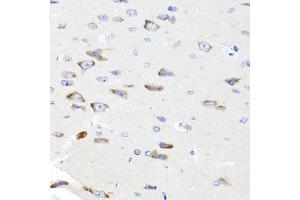 Immunohistochemistry of paraffin-embedded rat brain using PIK3CA antibody. (PIK3CA antibody)