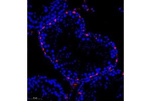 Immunofluorescence of paraffin embedded rat testis using kb12 (ABIN7075406) at dilution of 1:700 (260x lens) (p130 antibody)