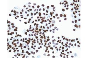 Immunohistochemical staining of SV40 large T, small t antigen. (SV40 Large T and Small Ts antibody)