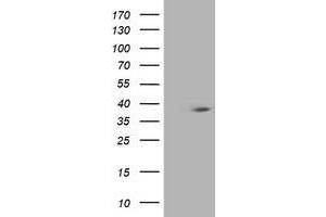 HEK293T cells were transfected with the pCMV6-ENTRY control (Left lane) or pCMV6-ENTRY HSPBP1 (Right lane) cDNA for 48 hrs and lysed. (HSPBP1 antibody)