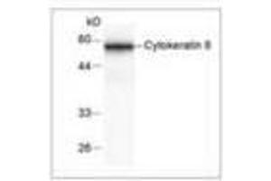 Image no. 2 for anti-Keratin 8 (KRT8) antibody (ABIN791530) (KRT8 antibody)