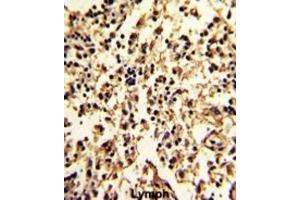 Immunohistochemistry (IHC) image for anti-serpin Peptidase Inhibitor, Clade A (Alpha-1 Antiproteinase, Antitrypsin), Member 9 (SERPINA9) antibody (ABIN3004177) (SERPINA9 antibody)