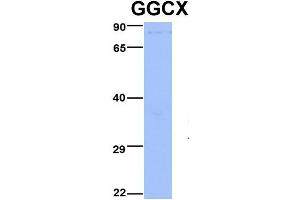 Host:  Rabbit  Target Name:  GGCX  Sample Type:  Jurkat  Antibody Dilution:  1. (GGCX antibody  (Middle Region))