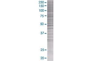 Western Blotting (WB) image for UMOD 293T Cell Transient Overexpression Lysate(Denatured) (ABIN1333854)