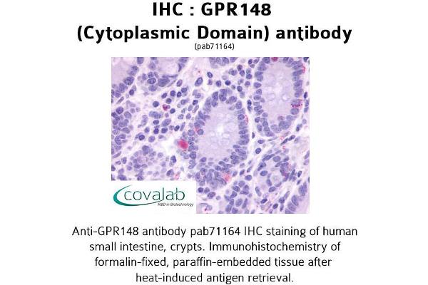 GPR148 antibody  (3rd Cytoplasmic Domain)
