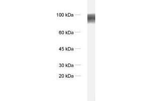 dilution: 1 : 1000, sample: synaptic membrane fraction of rat brain (LP1) (ADAM22 antibody)