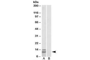 Western blot testing of human gastrointestinal cancer lysate and p15 INK4b antibody at 1ug/ml with [B] and without [A] immunizing peptide. (CDKN2B antibody  (Isoform 2))