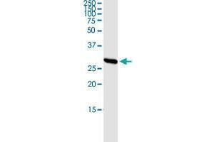 Immunoprecipitation of PRSS1 transfected lysate using rabbit polyclonal anti-PRSS1 and Protein A Magnetic Bead (PRSS1 (Human) IP-WB Antibody Pair)