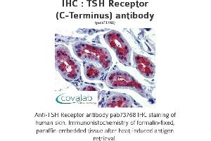 Image no. 1 for anti-Thyroid Stimulating Hormone Receptor (TSHR) (C-Term) antibody (ABIN1740418) (TSH receptor antibody  (C-Term))