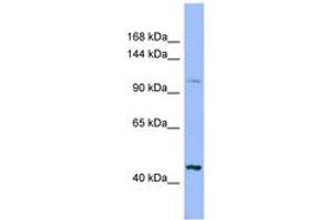 Image no. 1 for anti-Xylosyltransferase II (XYLT2) (AA 575-624) antibody (ABIN6741764) (XYLT2 antibody  (AA 575-624))
