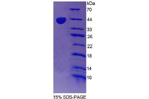 SDS-PAGE (SDS) image for Nuclear Receptor Subfamily 2, Group C, Member 1 (NR2C1) (AA 1-324) protein (His tag) (ABIN4990122) (NR2C1 Protein (AA 1-324) (His tag))