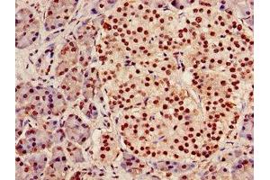Immunohistochemistry of paraffin-embedded human pancreatic tissue using ABIN7142023 at dilution of 1:100 (AGPAT5 antibody  (AA 174-313))