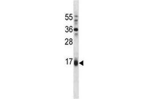 Puma antibody western blot analysis in A549 lysate. (PUMA antibody  (AA 109-137))