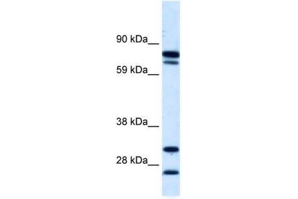 ZNF606 anticorps  (N-Term)