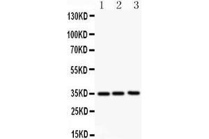 Anti- GM-CSF antibody, Western blotting All lanes: Anti GM-CSF  at 0. (GM-CSF antibody  (Middle Region))