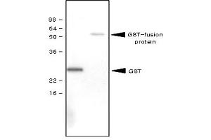 Western Blotting (WB) image for anti-Glutathione S Transferase (GST) antibody (ABIN165402) (GST antibody)