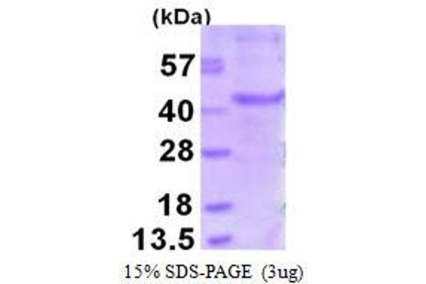 MAGEA6 Protein (His tag)