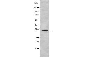 Western blot analysis OR56B2 using HT-29 whole cell lysates (OR56B2 antibody)